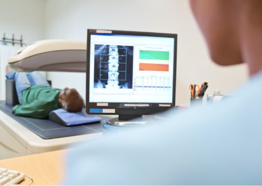 A patient is lying on a bone densitometer while the technician looks at the spinal cord image on a monitor.
